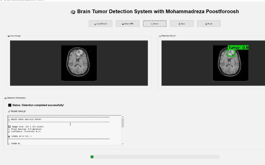 سیستم تشخیص تومور مغزی (Brain Tomor Detection)