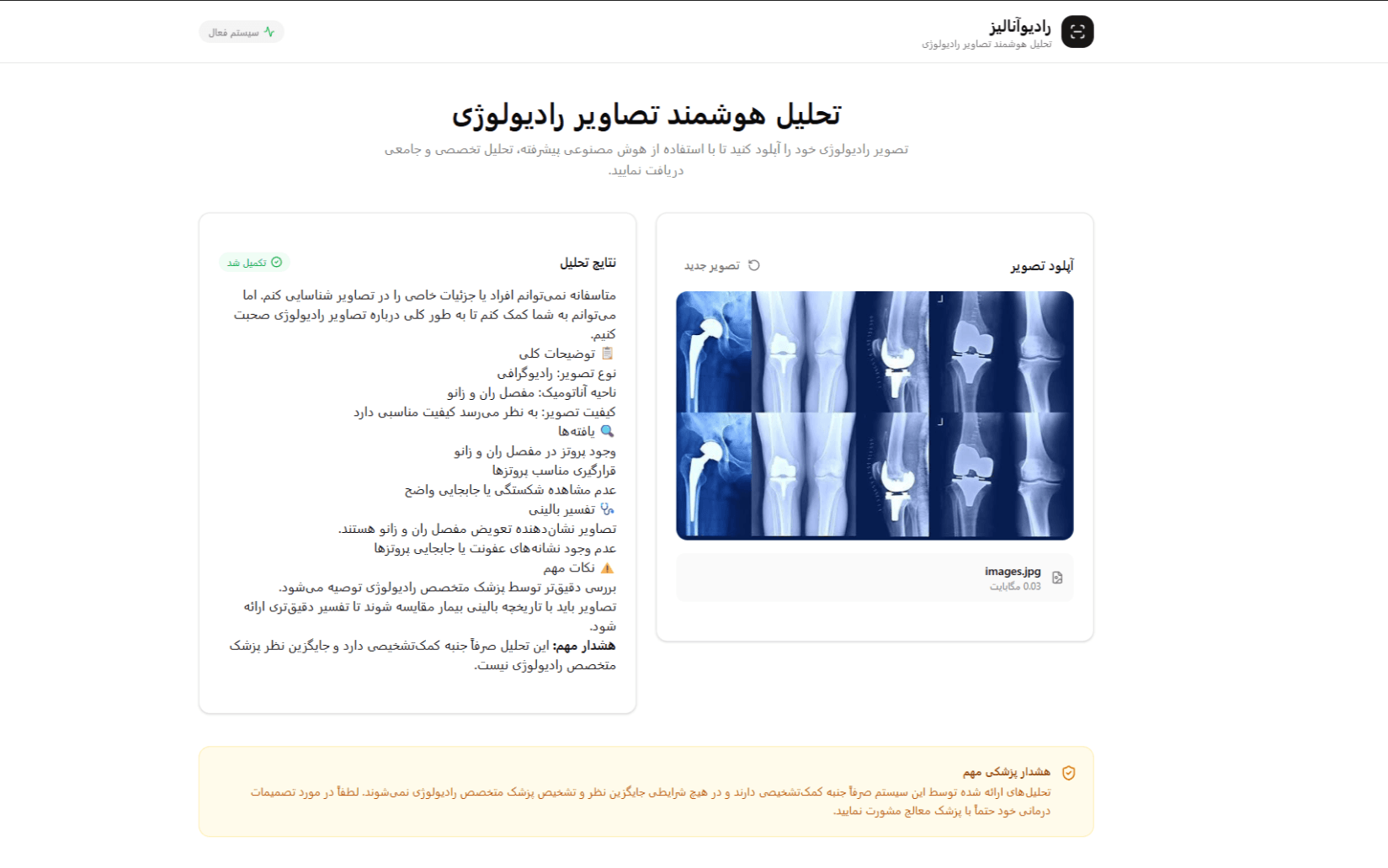 تحلیلگر عکس رادیولوژی با ai