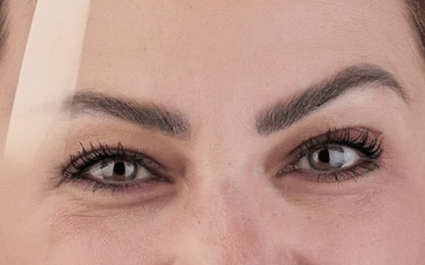نمونه کار ویدیو قبل و بعد (Before & After) دندانپزشکی